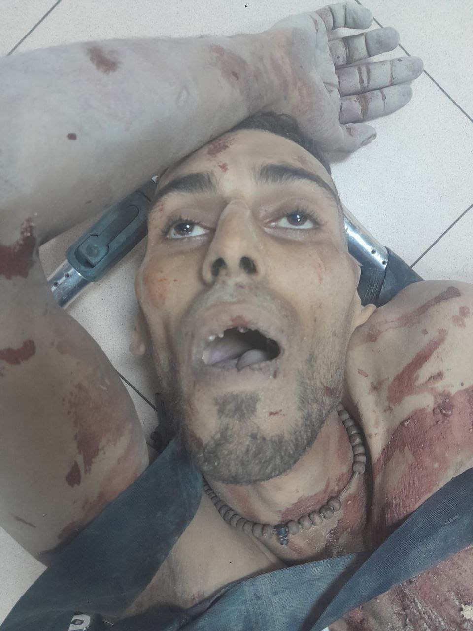 The arrival of an unidentified martyr to Al -Aqsa Martyrs Hospital, who was pulled from Netsarim.