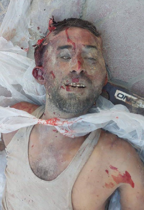 There is no power or strength except in God .. An unidentified martyr arrived shortly before the Mir
