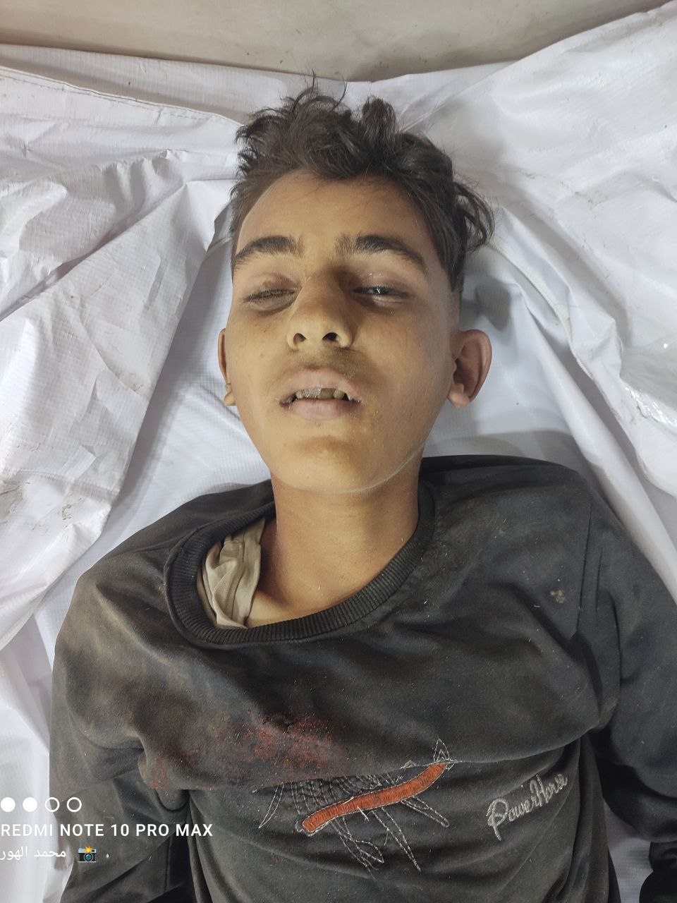 An unidentified child martyr arrived in Al -Awda Hospital in Nasayrat from targeting Natsarim