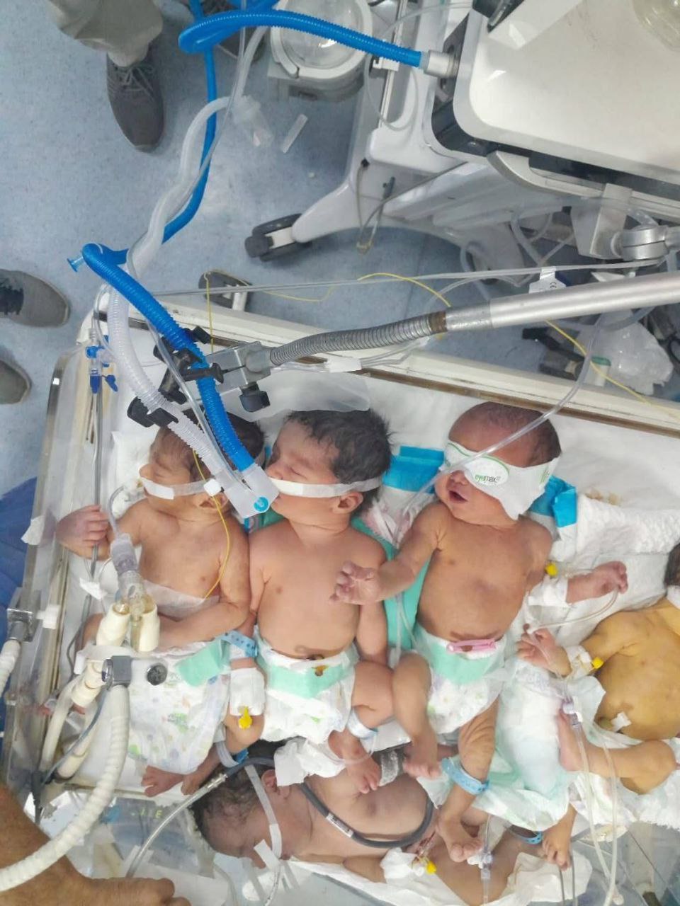 Khedive children accumulate in hospitals due to the power outages and fuel running