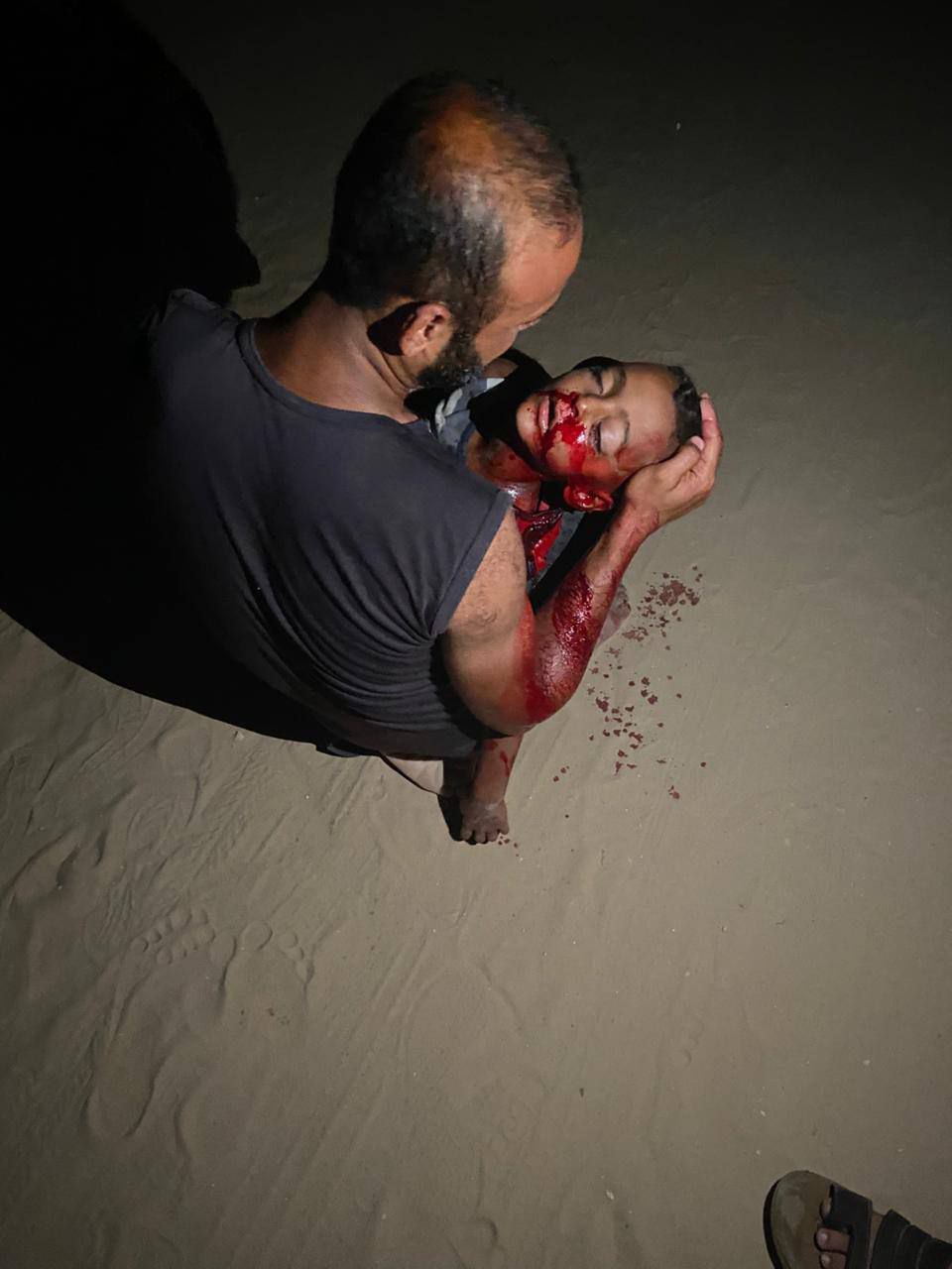 A child was injured as a result of the shooting of Kiwad Cabter aircraft on the tents of the displac