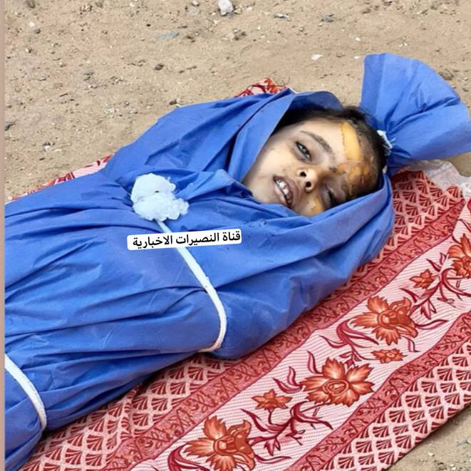The child martyr: Healing Moaz Awad Muslim.Which was martyred after bombing her house, at dawn today