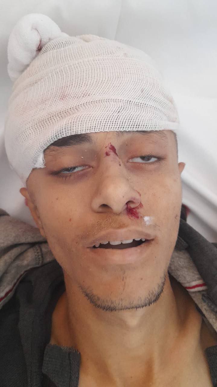 Israel has murdered an unidentified individual near the Shalhoush Aid Center in the north of Rafah.