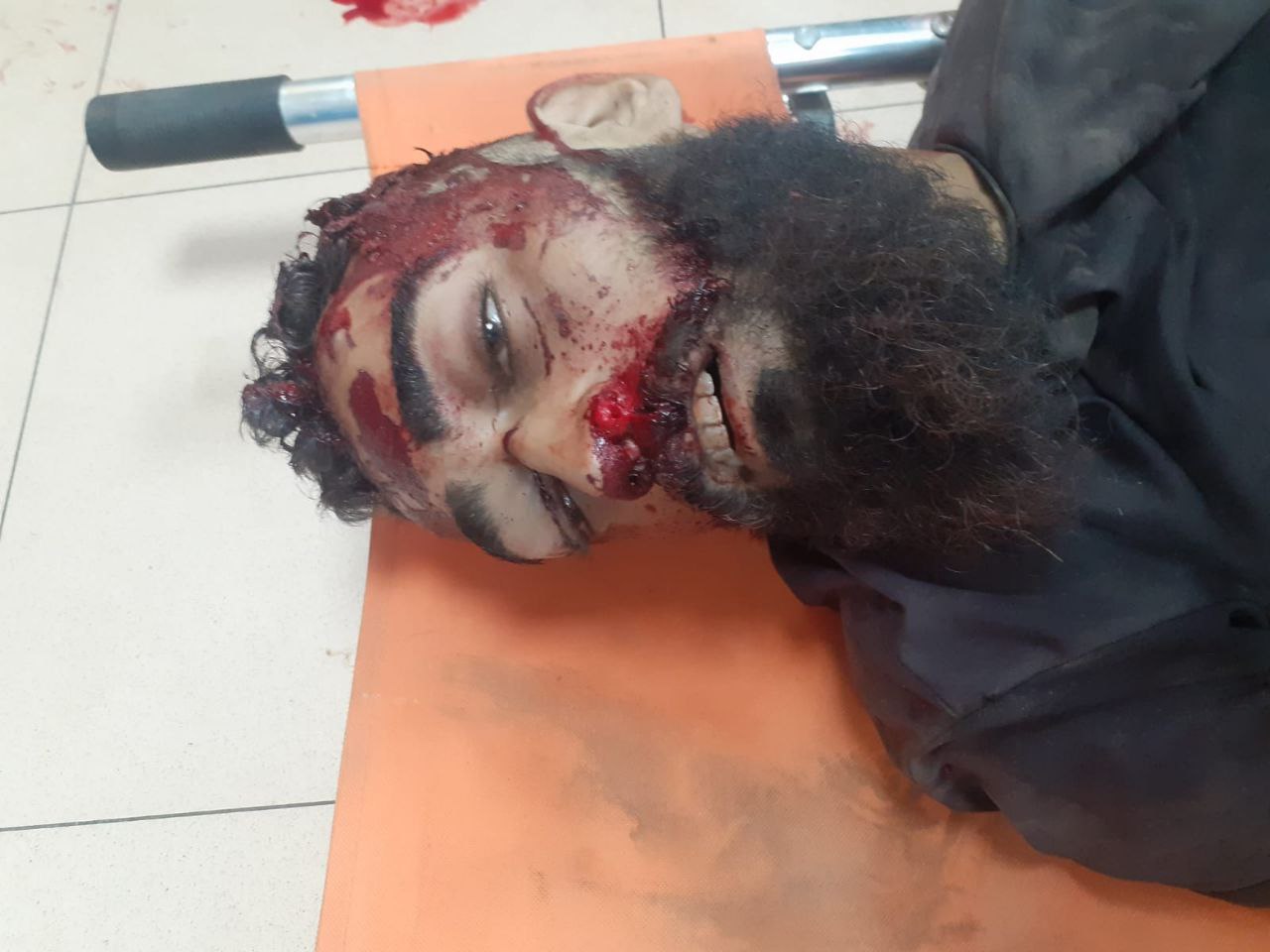 A martyr from the awaited aid inside Al -Aqsa Hospital