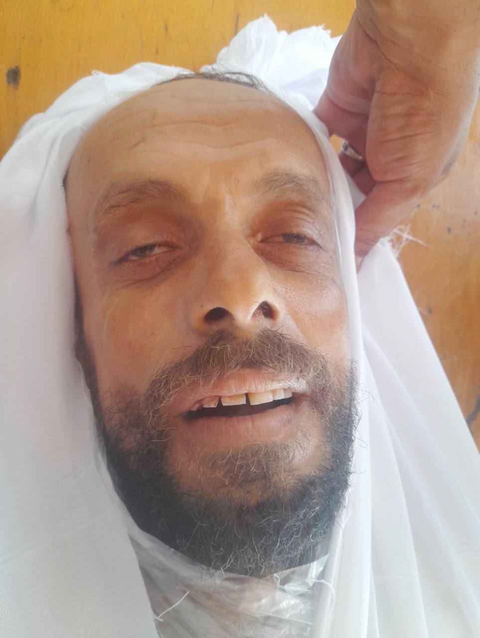 An unidentified martyr in Al -Ma’dani Hospital, whoever recognizes him to communicate with his famil