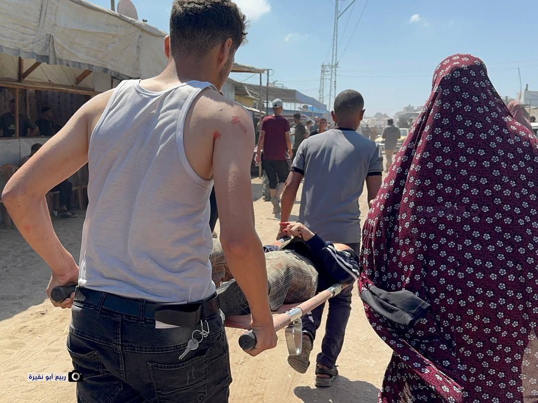 From the arrival of 9 martyrs to the Kuwait Hospital after targeting the tents of the displaced with