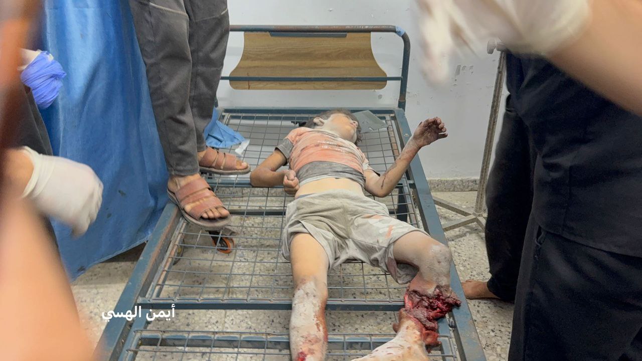 🌟🌟 Chemel and injured in targeting a house belonging to the Al -Hawajari family and next to it a hou