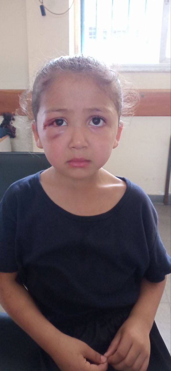 Rasha Muhammad Abu Asal's child is lost in the Nuseirat market now at Abu Uriban School. Contact on