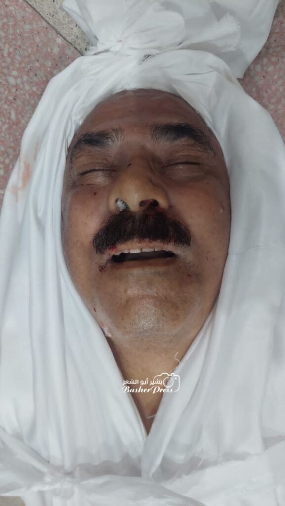 Israel murders Dr. Ahmed Qandil in a bombardment of the Al-Samar area in central Gaza City.