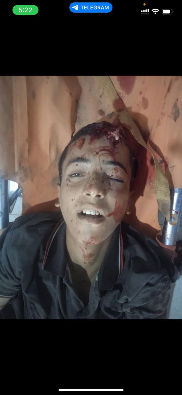 An unidentified martyr from the Shakoush area is located in the cross and will be transferred to Nas