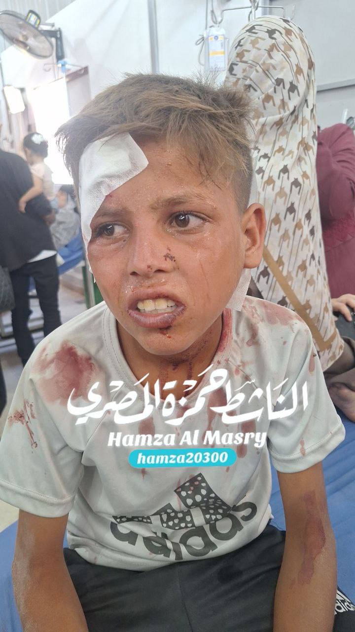 Follow -up .... An infected child, not identified, or access to his family is in Al -Awda Hospital i