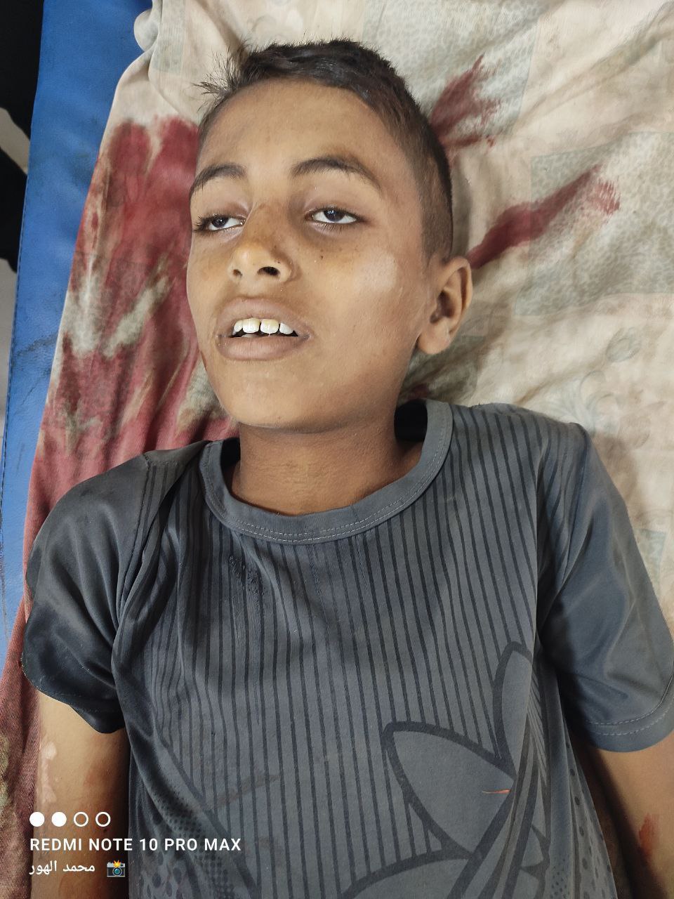 Urgent_ The arrival of a child's martyr to Al -Awda Hospital in Nasayrat from Natsarim
