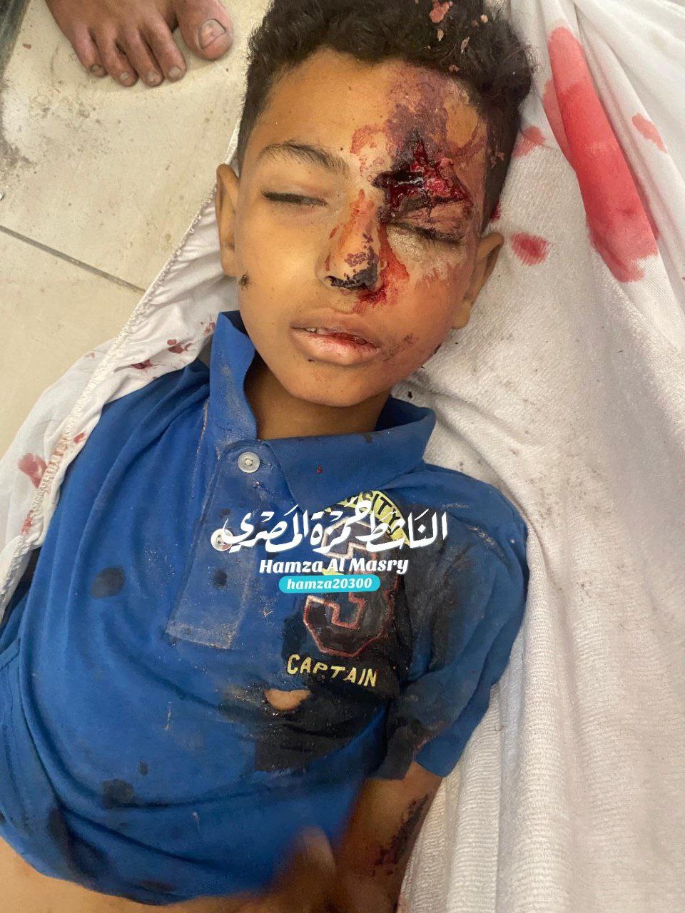 Anonymous martyr was recovered from 10 Street. It is located in Gaza University Street 8 within half