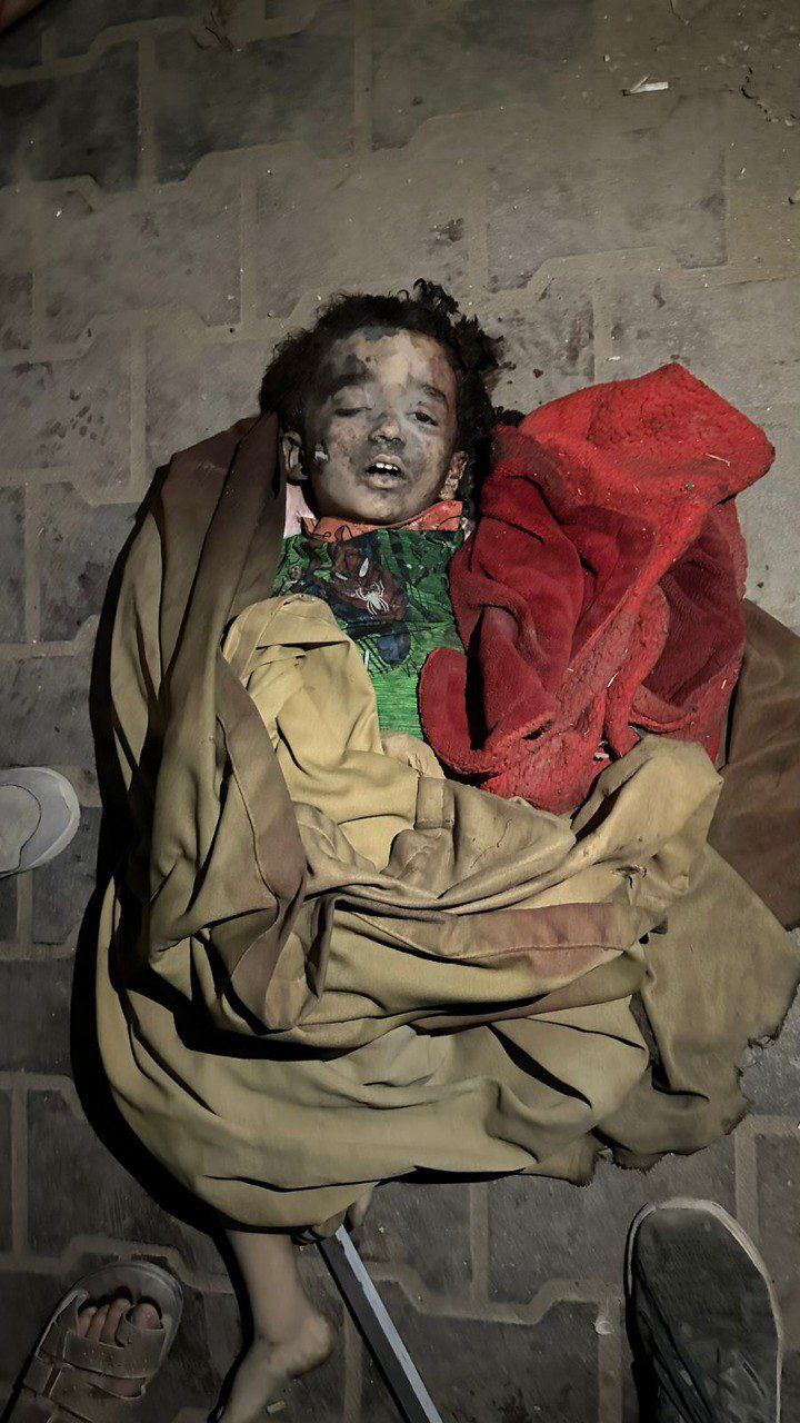 An unknown martyr child, who came to Al -Shifa shortly before targeting Al -Galaa Street, "Abdel -Al