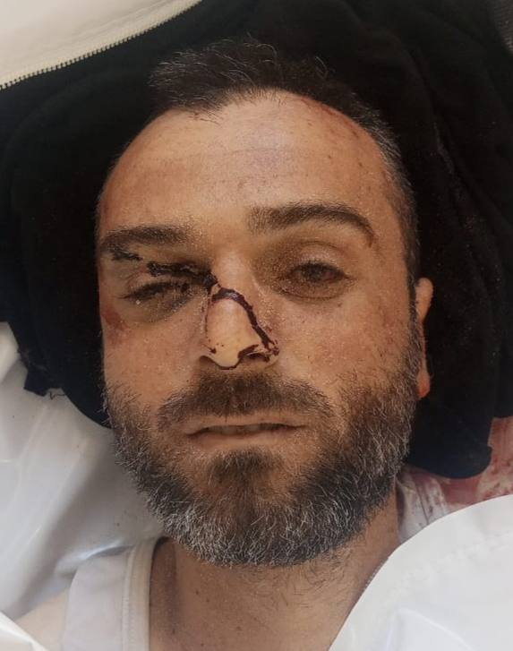 Anonymous martyr from Al -Shakoush area, north of Rafah.