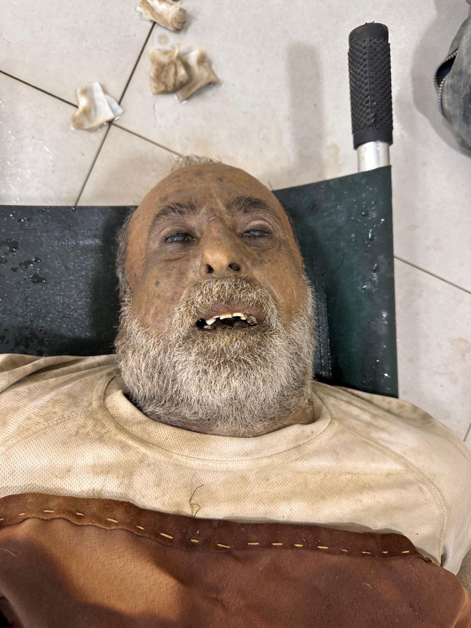 A picture of the anonymous martyr from the north of Nusseirat camp. He is now in Al -Awda Hospital A