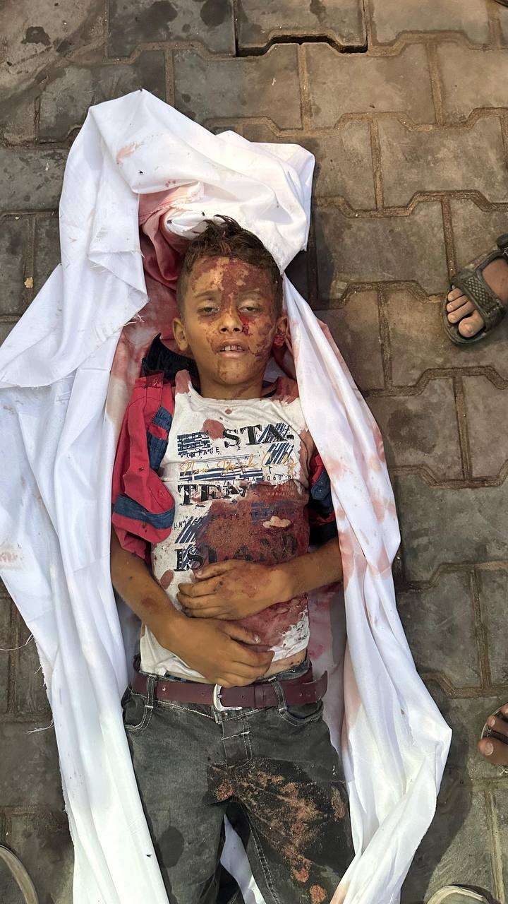 An unknown martyr child, who is in Al -Shifa Hospital from targeting the country, has not yet recogn