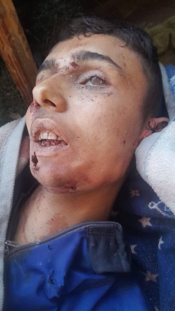 🚫🚫 Two martyrs, anonymous, are at the door of Halima Al -Saadia School in Nazlet Jabalia, and next t