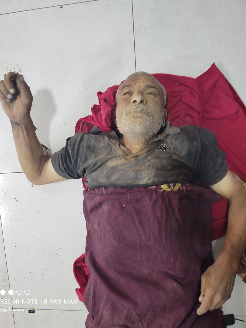 Follow -up _ The arrival of a martyr now to Al -Awda Hospital in Al -Nasayrat from the Da`wah area