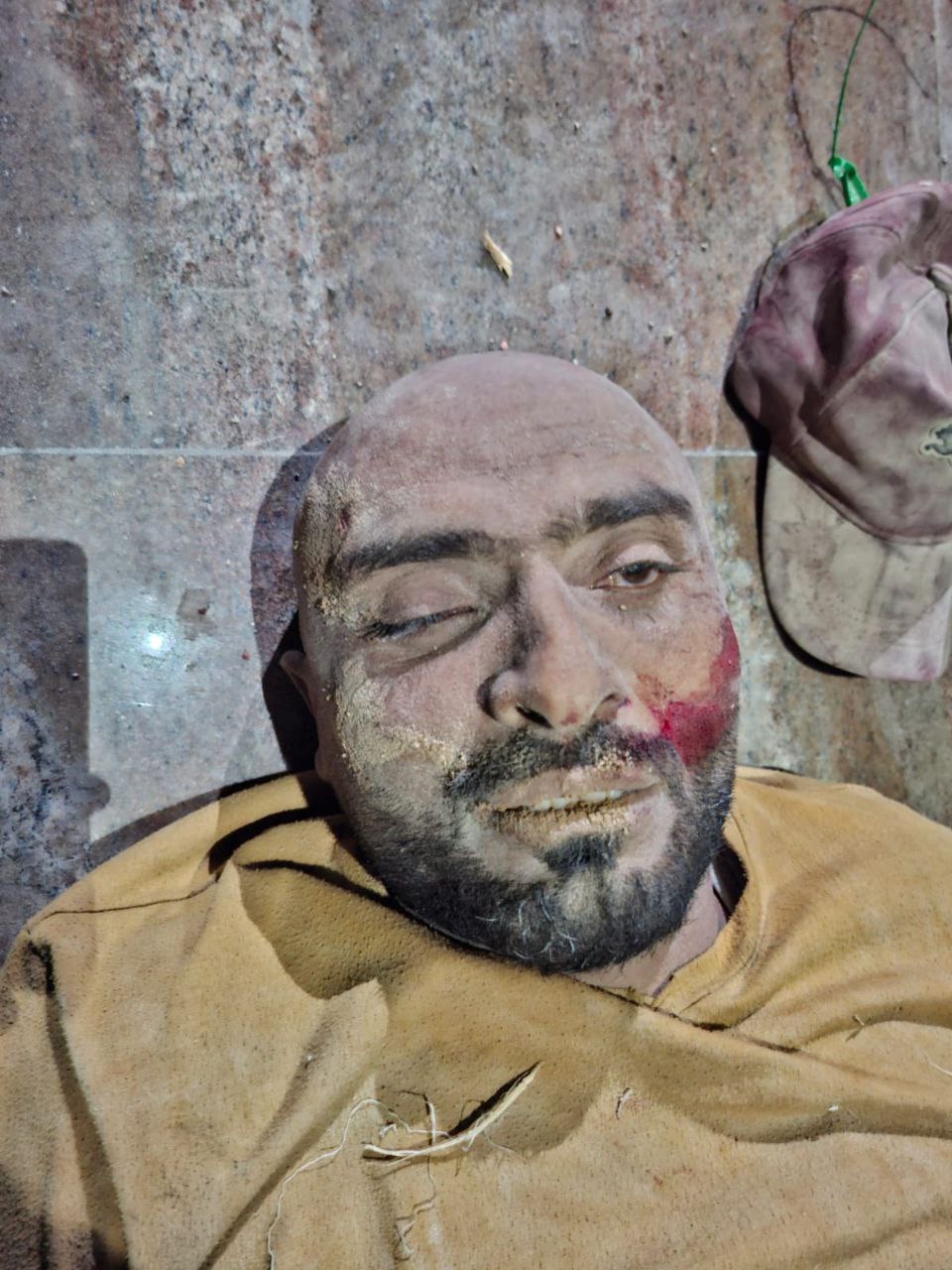 The arrival of a martyr and an unidentified martyr to Hamad Hospital from the awaits of aid in the n