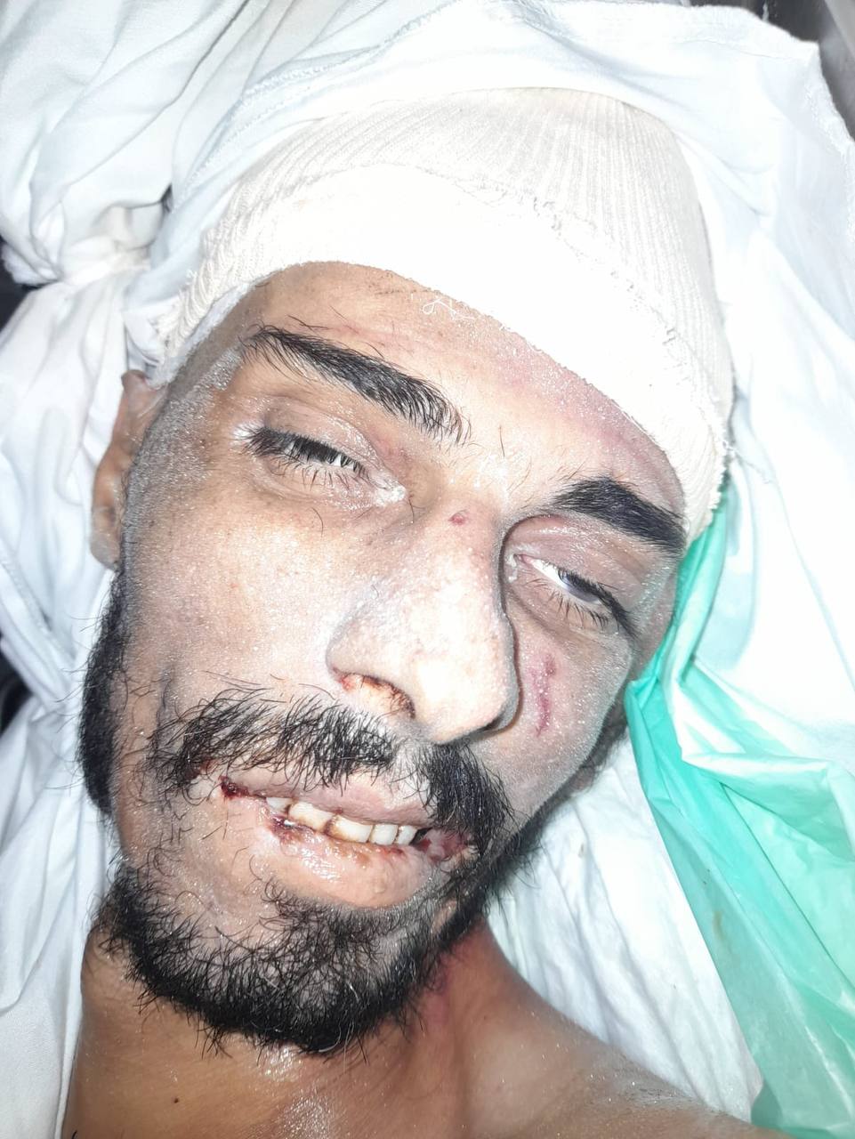 The martyr / Mohamed Thabet from July 20, who is in the morgue of the Nasser Complex.