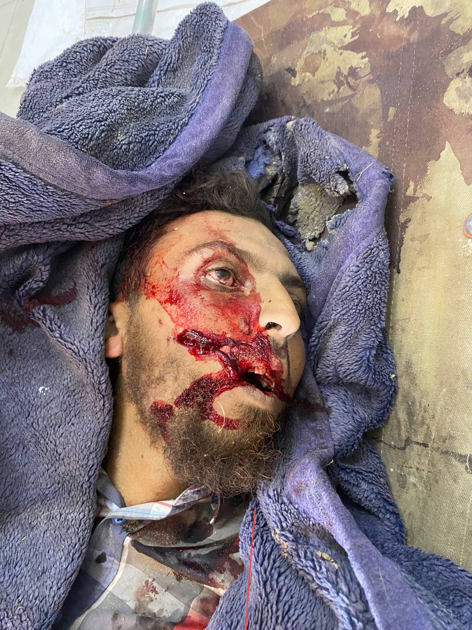 Follow -up - photos; From the massacre committed by the occupation army, by bombing a tent with a we