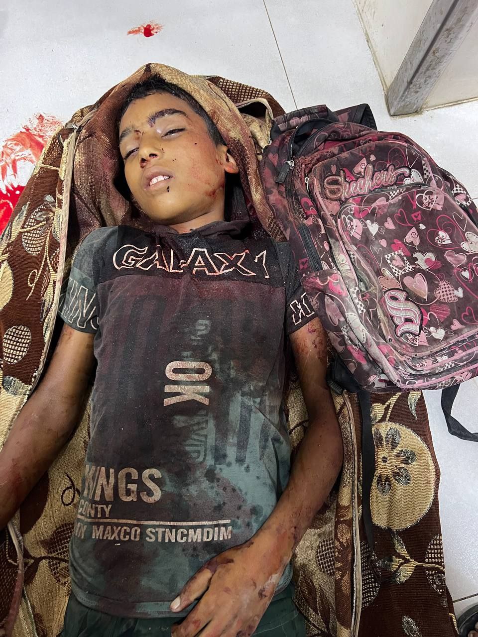 One of the martyrs of Natsarim is an unidentified child
