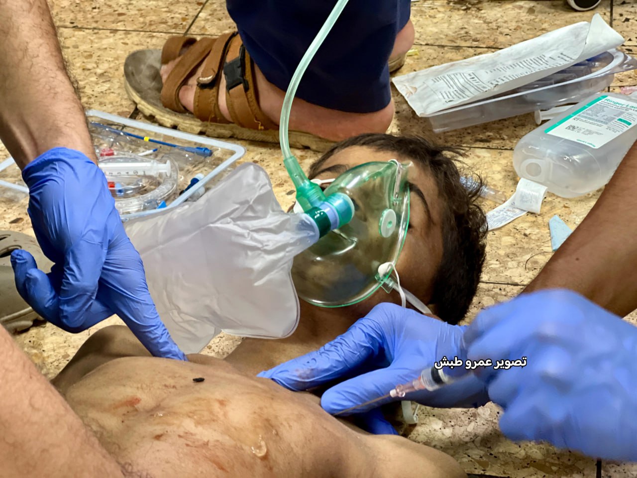 Photo: More than seven doctors are drained, all of their energy in the emergency room and resuscitat