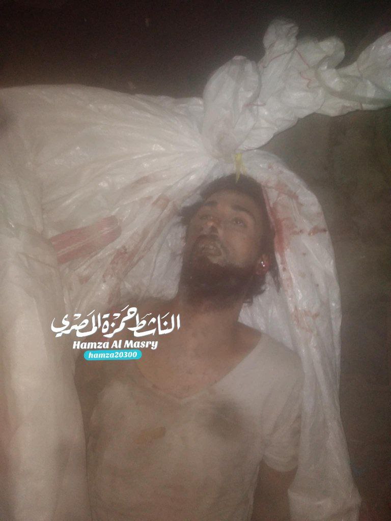 Anonymous martyr is located in Al -Shifa Hospital