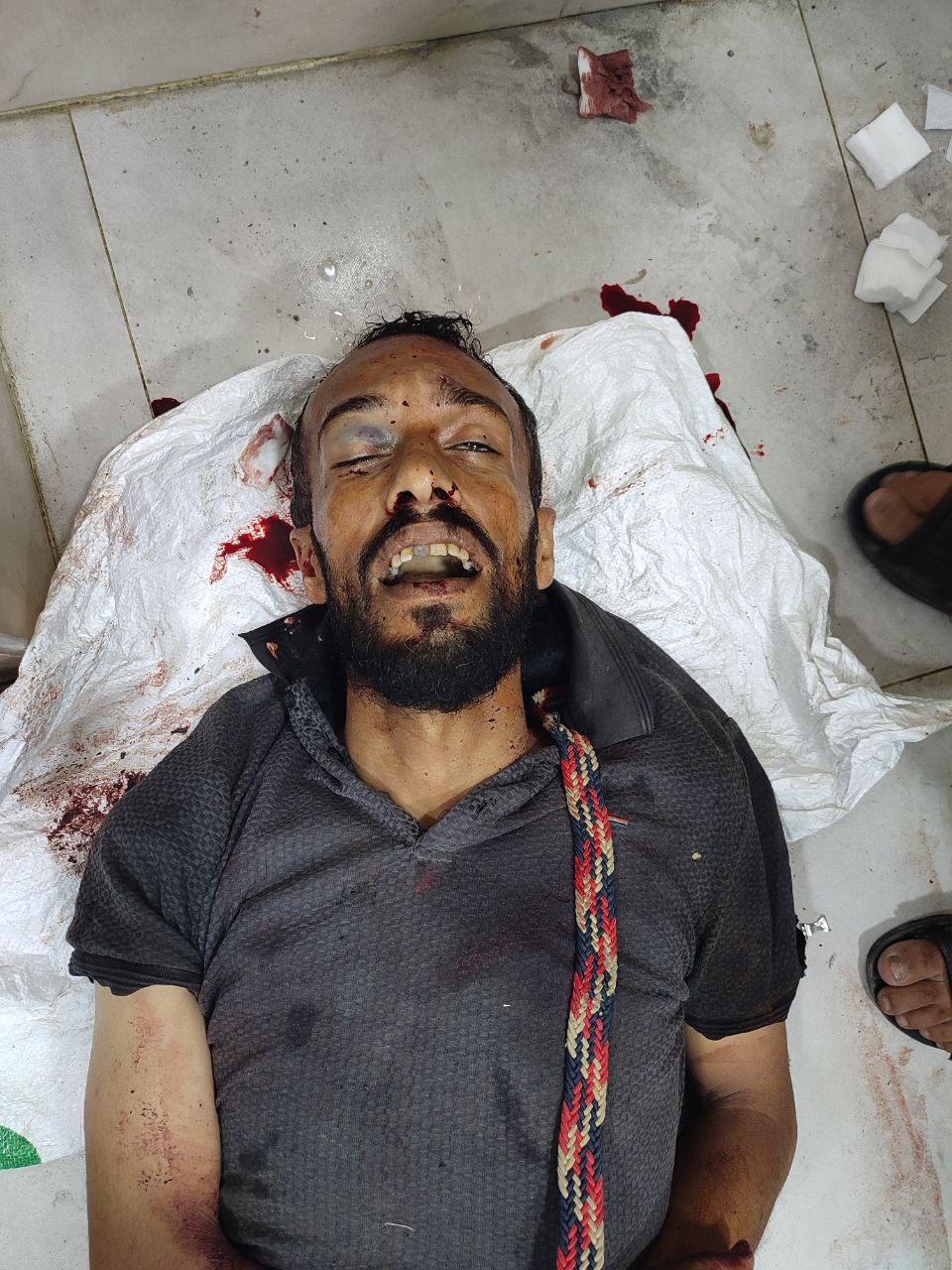 Anonymous martyr Al -Awda Hospital arrived in Nasayrat from Natsarim
