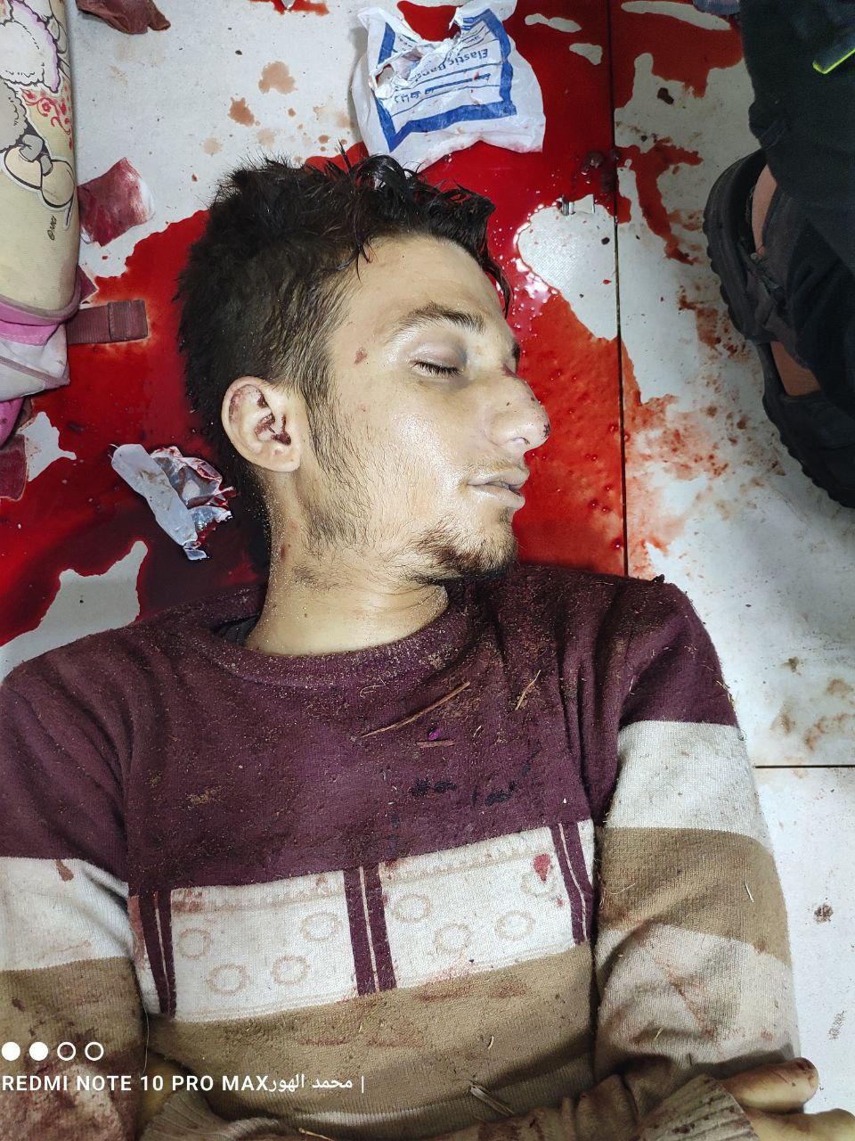 Anonymous martyr Al -Awda Hospital arrived in Nasayrat from Natsarim