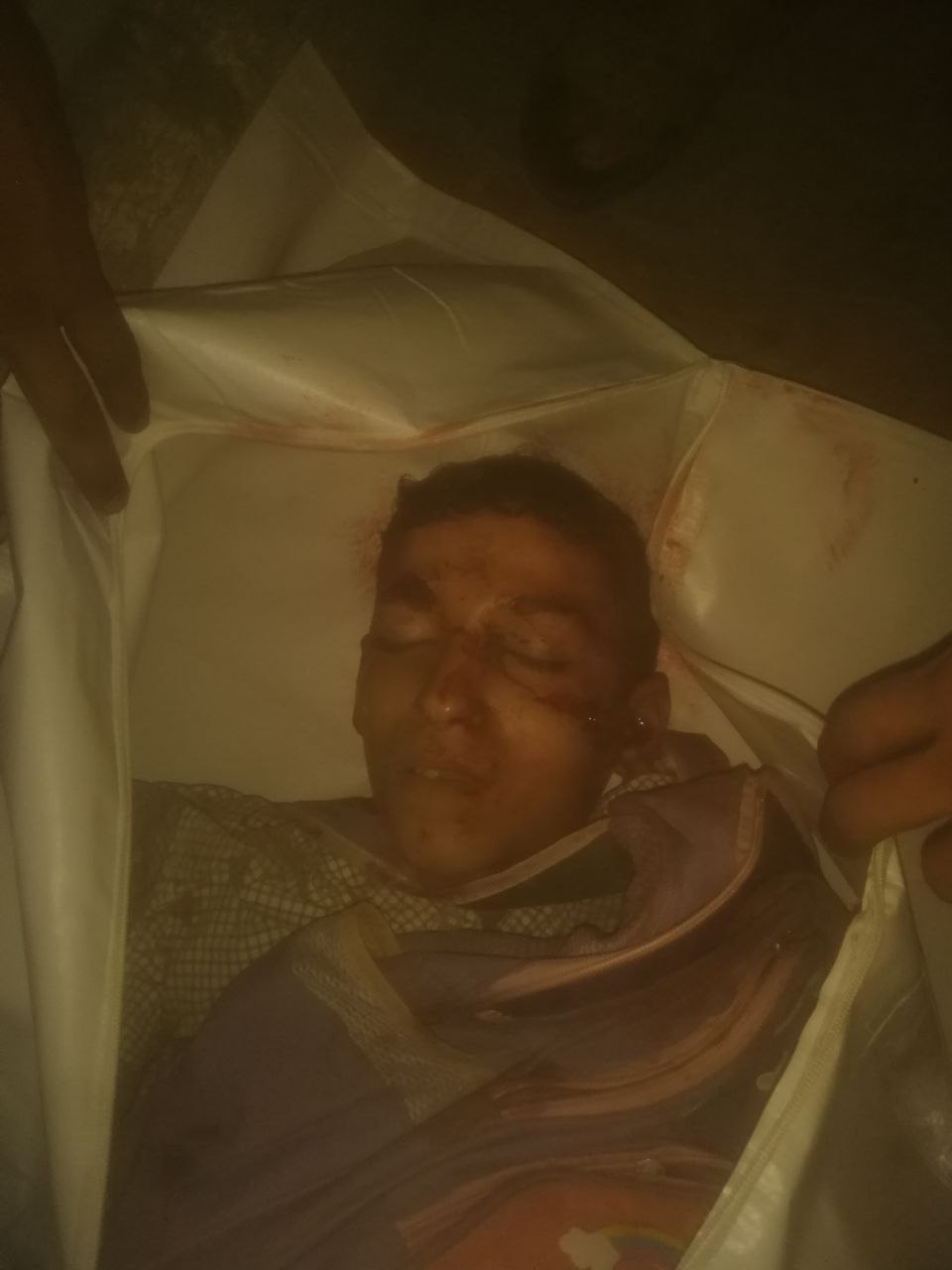Unidentified martyrs are in the Sheikh Radwan clinic northwest of Gaza City.