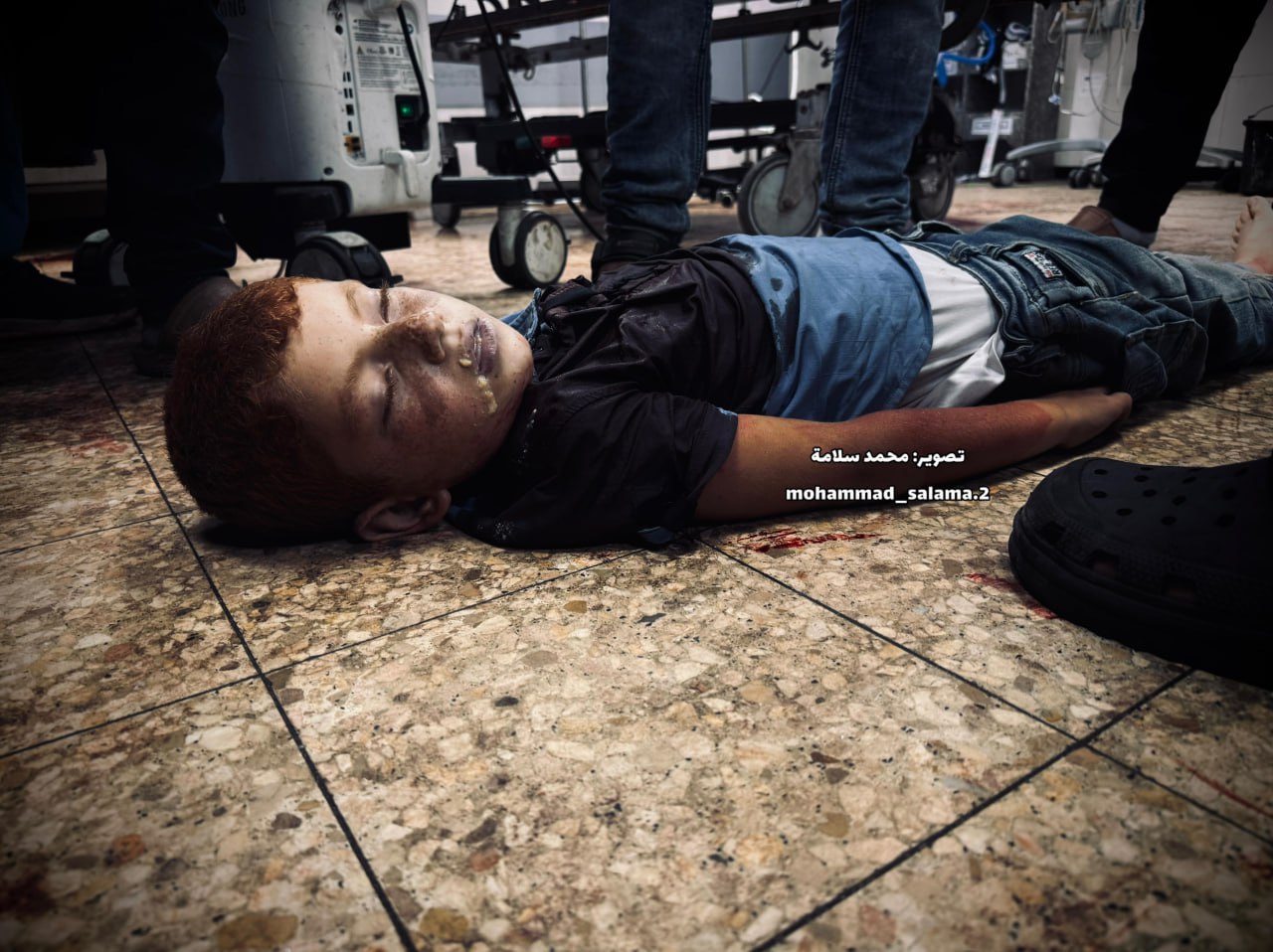A child was martyred after the occupation bombed the tents of the displaced near the Tiba Towers, we