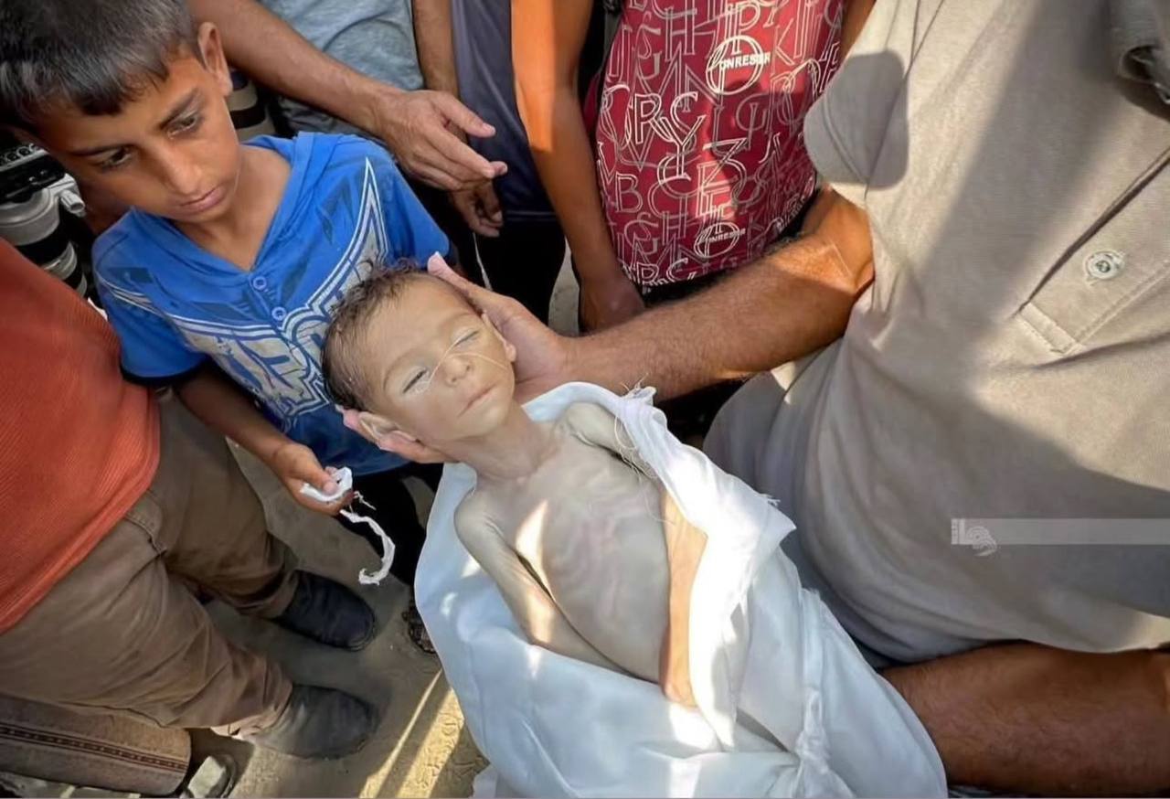 🔴 Urgent difficult event - the death of a child in the Gaza Strip due to famine and lack of food