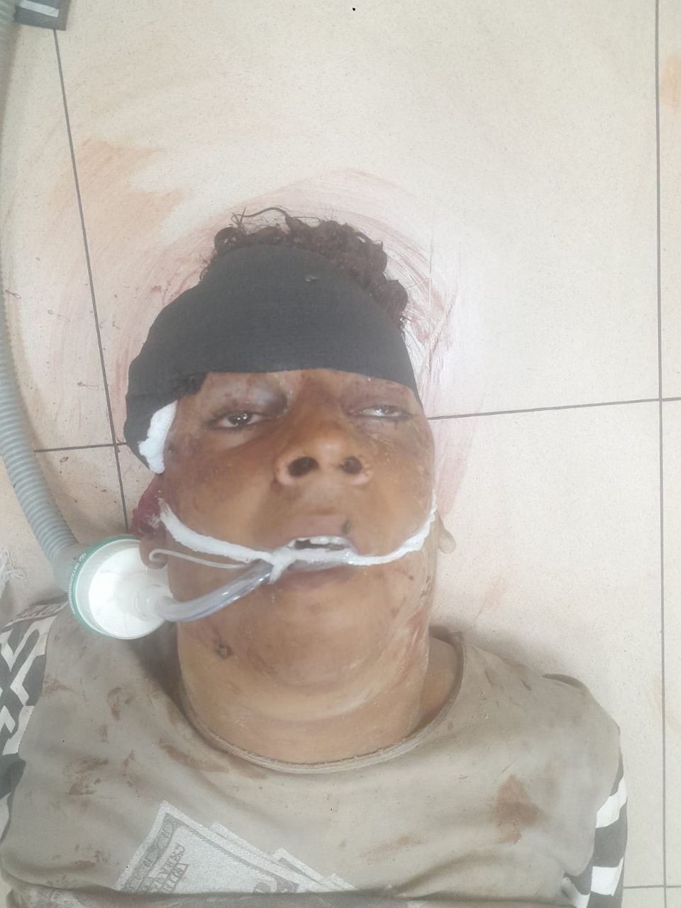 An unidentified injury from Netsarim has arrived at Al -Aqsa Martyrs Hospital, his serious condition