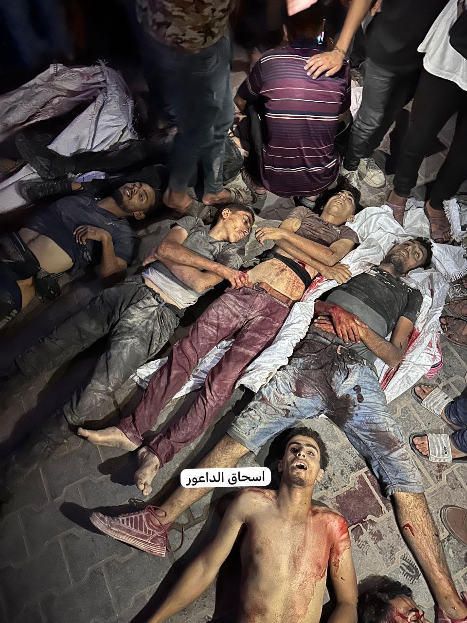 A new massacre .. The awaited aid in Zakim, until the moment, is about 25 martyrs and more than 150