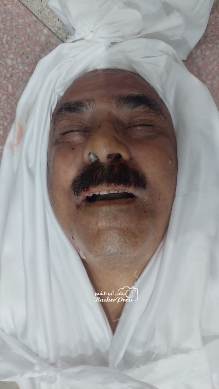 Urgent martyrdom of the doctor Ahmed Qandil in an Israeli bombing of the Samer area in the center of