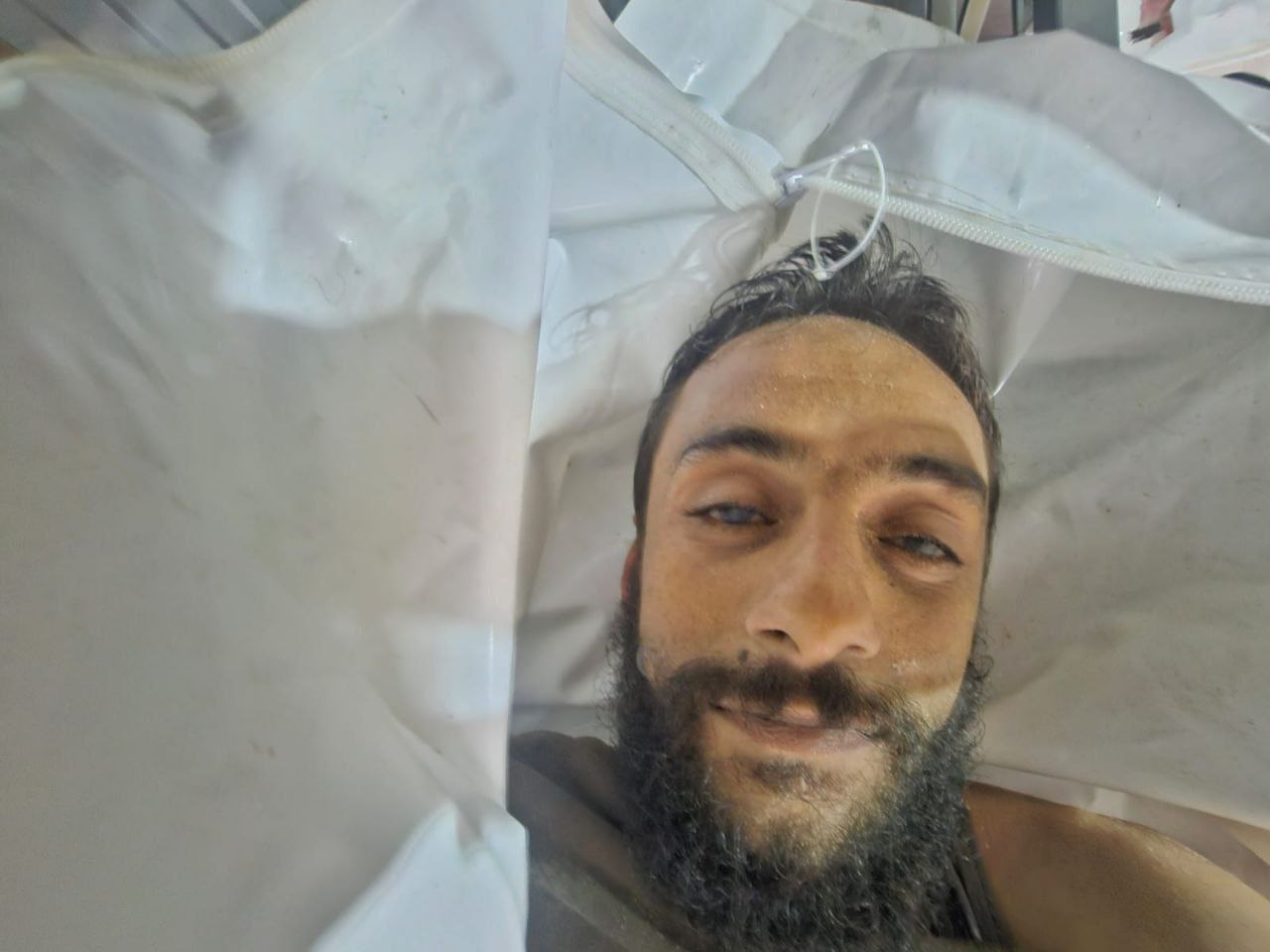 Anonymous martyr in Nasser Hospital from the bombing of a tent belonging to the Al -Majayed family i
