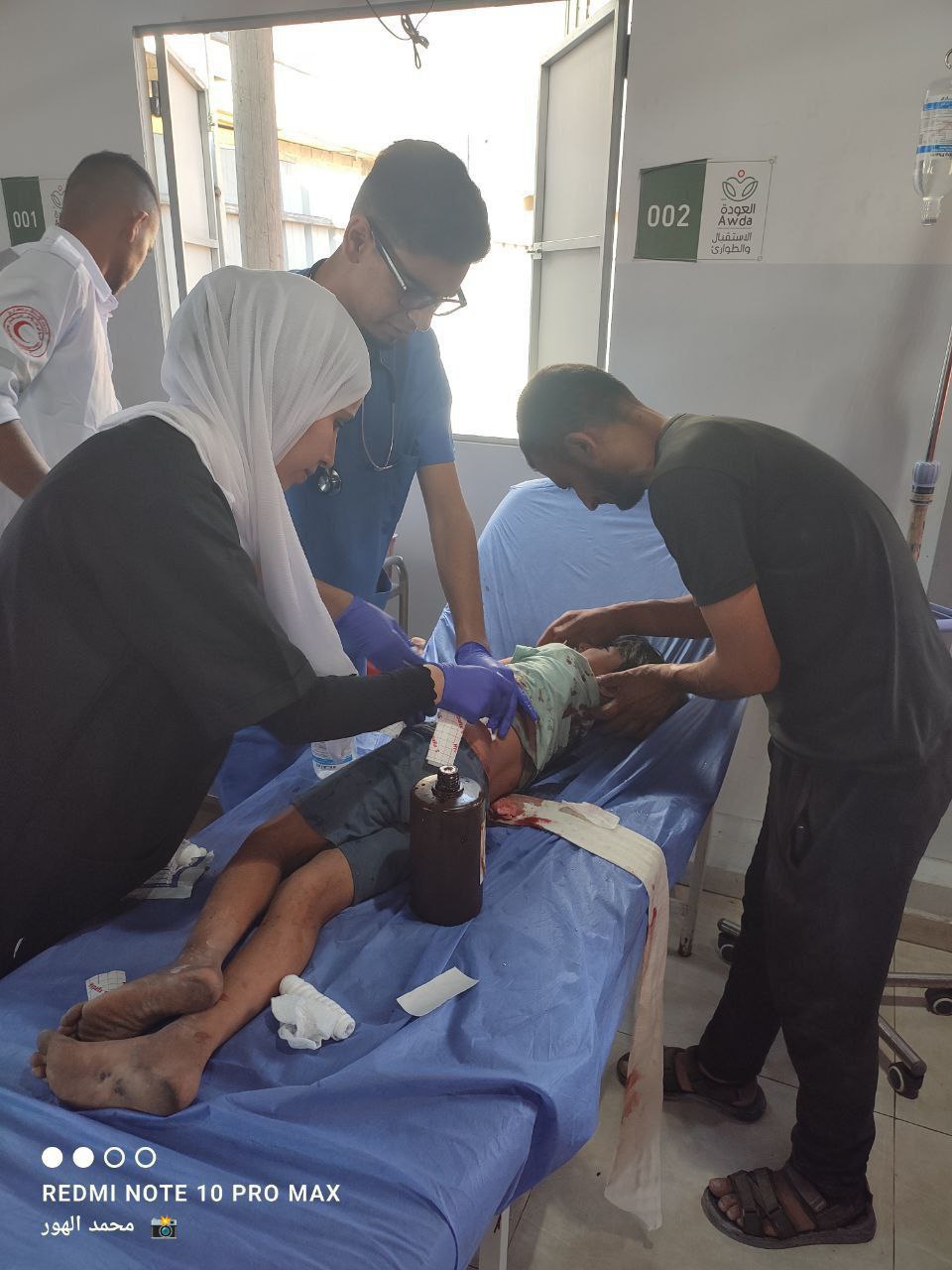 Urgent_ A child's martyr and injuries, most of them children, arrived at Al -Awda Hospital; As a res