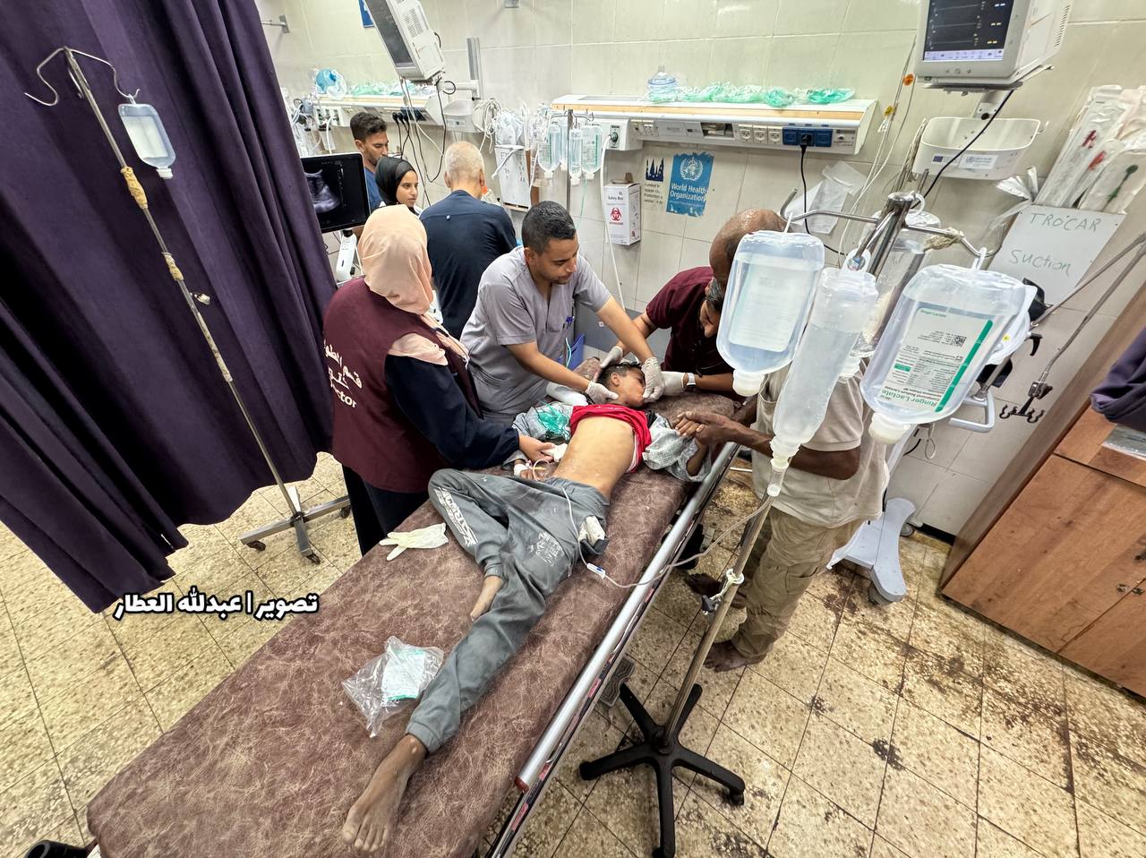 The arrival of the Nasser Medical Complex, a martyr of a child and a number of injuries, including c