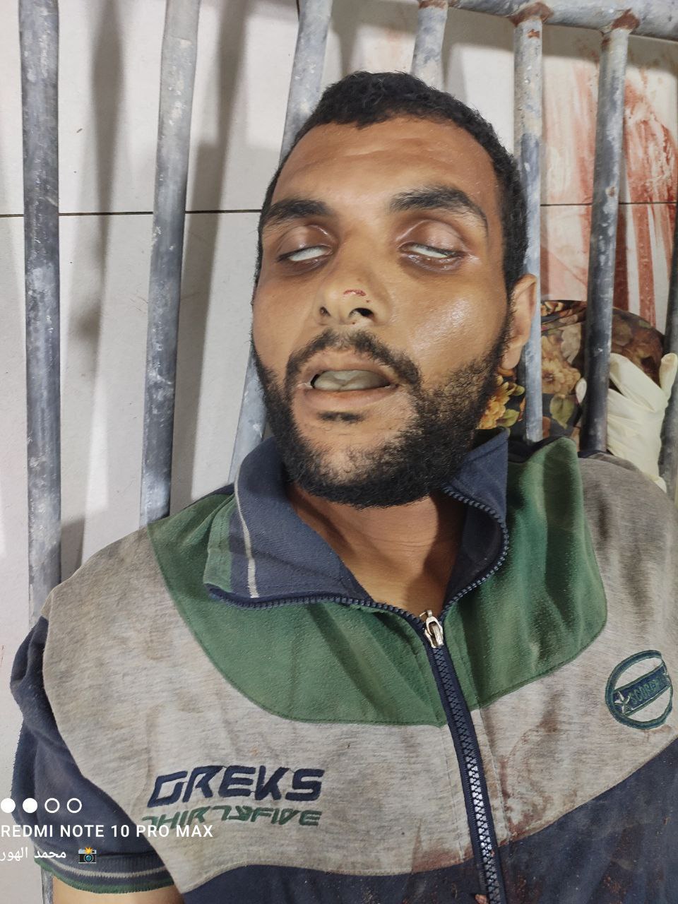 Follow -up_ The arrival of a martyr to Al -Awda Hospital in Al -Nasayrat from the area