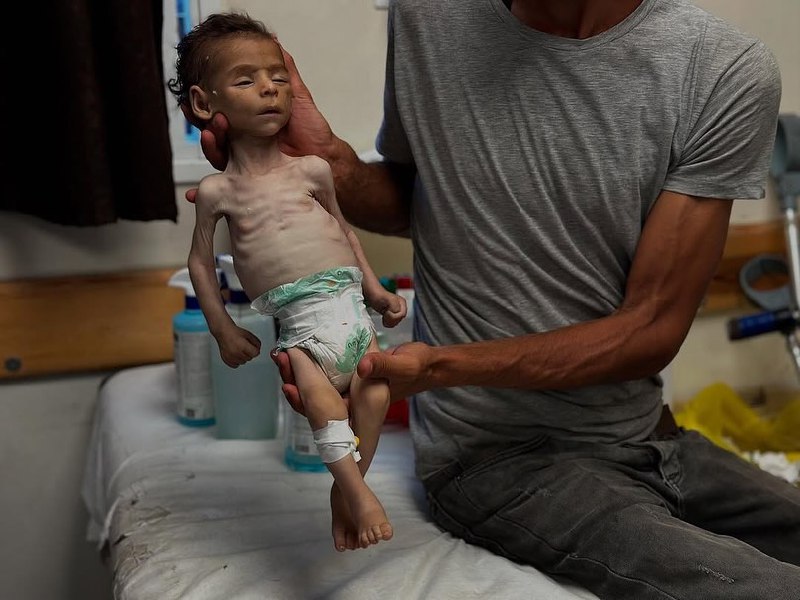 Hunger was martyred .. The infant Fadi Al -Najjar "3 months" from Khan Yunis, who was martyred as a