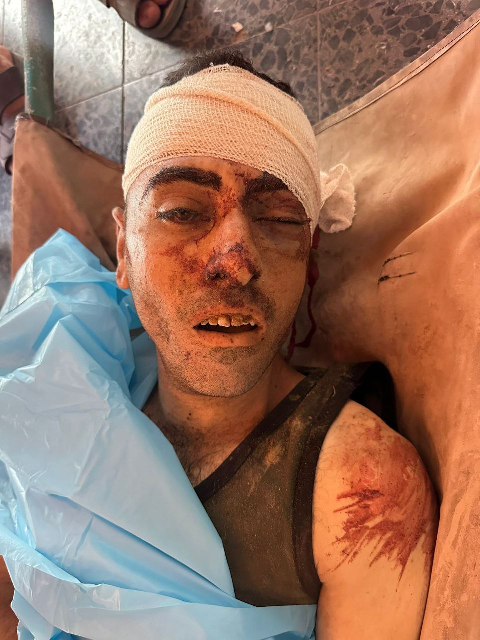 An unidentified second martyr arrived at Al -Ma’dani Hospital from the awaits of death aid in the Su