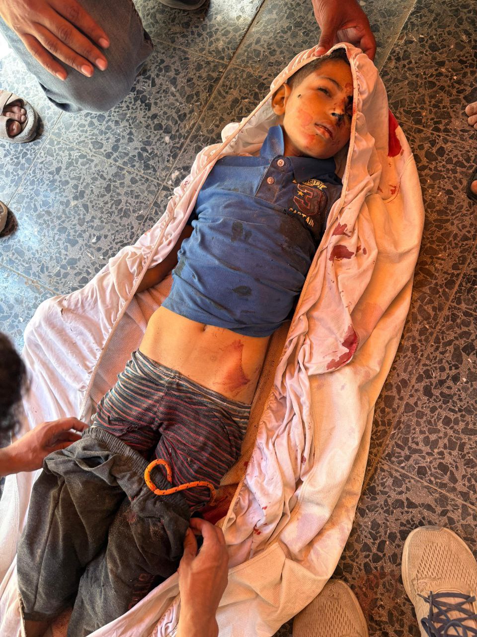 An unidentified martyr boy who has just arrived at Al -Maedani Hospital from Street 10 in the Al -Za
