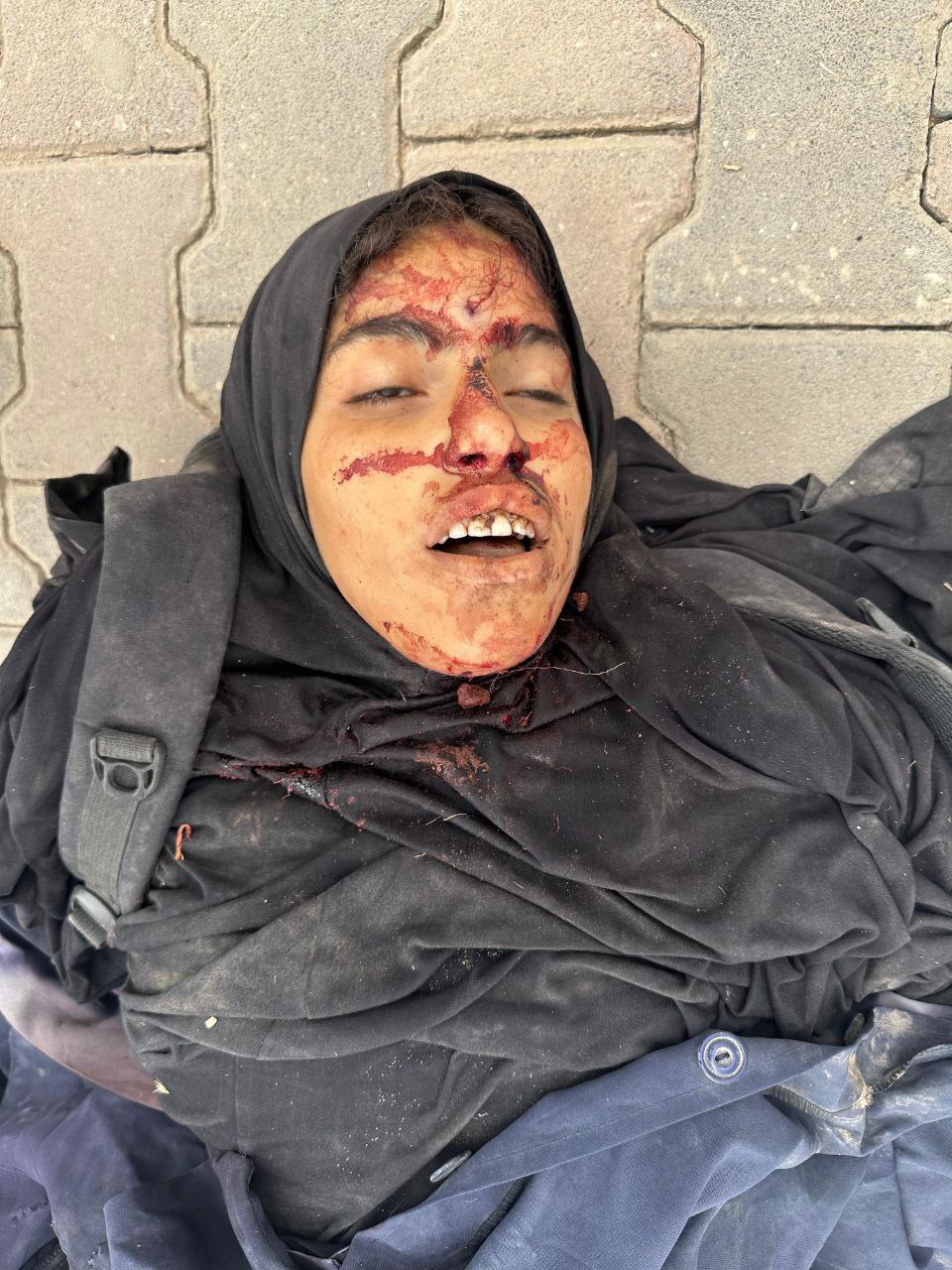 Anonymous martyr on Natsarim was transferred to Al -Aqsa Hospital