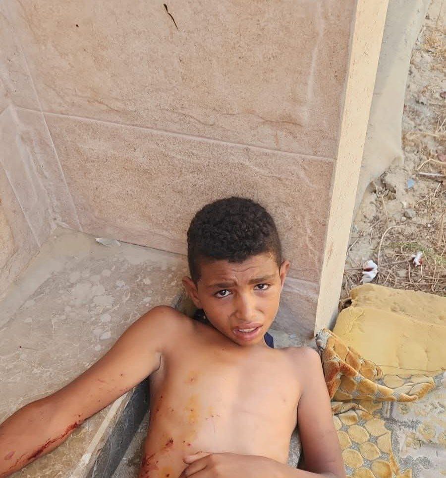 A group of citizens bombed a reconnaissance missile in Ramdeh, a talk about a martyr and a injured f