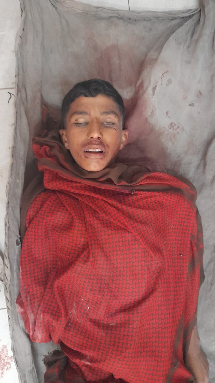 Anonymous martyr from the palm of a mortar