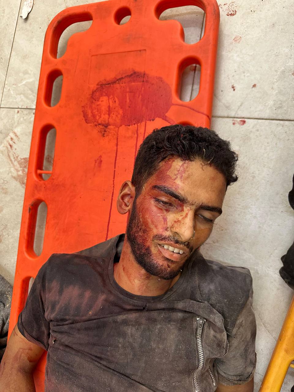 Unidentified martyrs in Nasser Medical Hospital.
