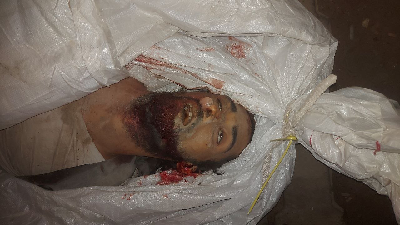 Image: An unidentified martyr from Zikim is located in Al -Shifa Hospital