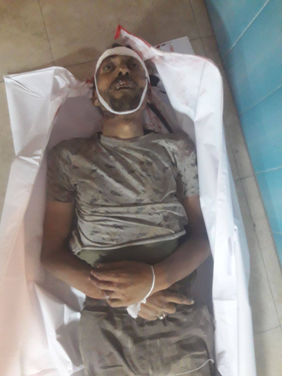 Photo Anonymous martyr in Al -Quds Hospital, west of Gaza City, from the Death trap area in Zikim.